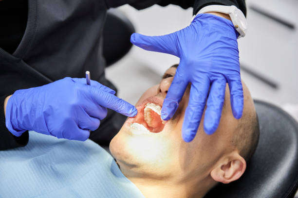 Best Emergency Tooth Extraction in Ke Arthur, LA