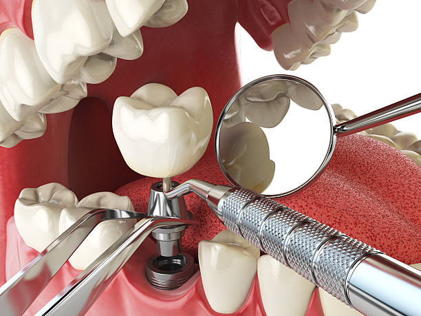  Ke Arthur, LA Emergency Dentist Pros