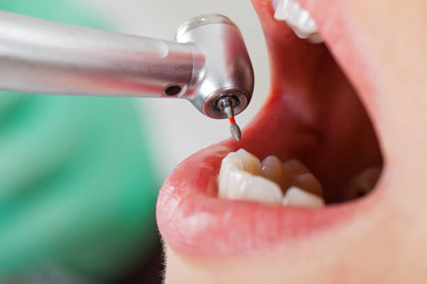 Best Same-Day Emergency Dental Services in Ke Arthur, LA